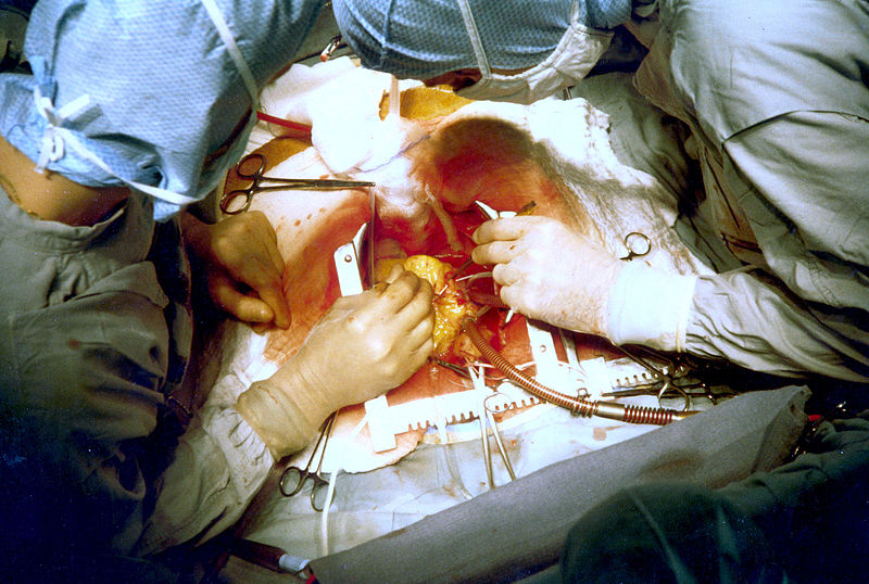 Cardiac surgery